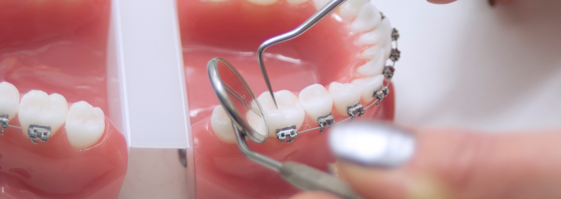 Denture retention means Dentflex